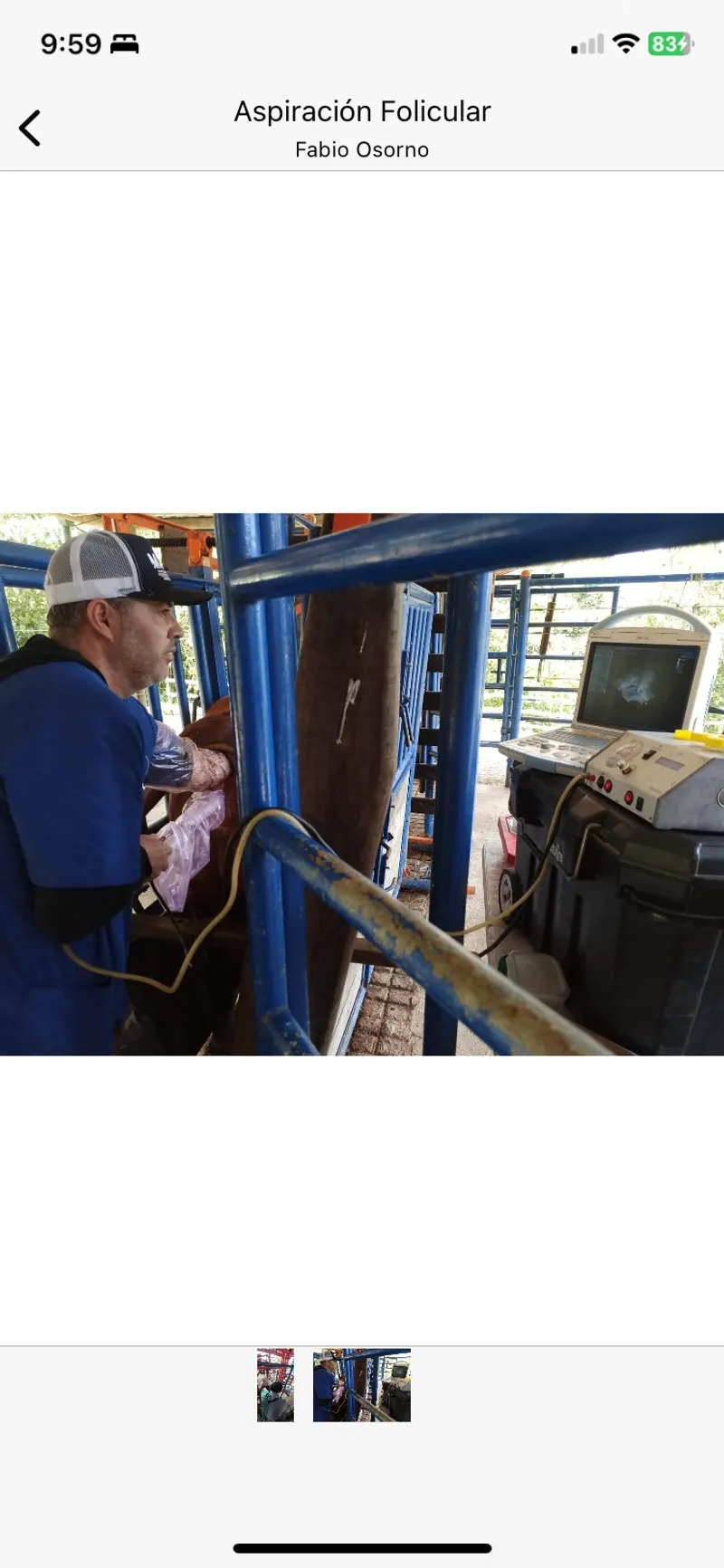 Aspiración folicular